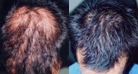 Alopecia Clinic 299504 Image 1