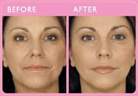 Revive Aesthetics Non Surgical Cosmetic Treatments 306203 Image 1