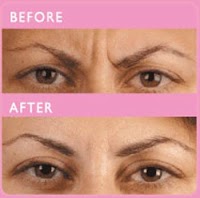 Revive Aesthetics Non Surgical Cosmetic Treatments 306203 Image 2
