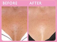 Revive Aesthetics Non Surgical Cosmetic Treatments 306203 Image 4