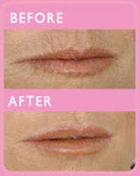 Revive Aesthetics Non Surgical Cosmetic Treatments 306203 Image 6