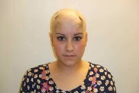 Alopecia Clinic 299504 Image 0