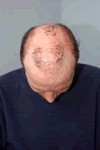 Alopecia Clinic 299504 Image 7