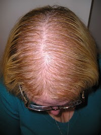 Alopecia Clinic 299504 Image 8