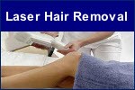 Finchley Laser Hair 298336 Image 0