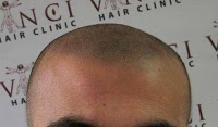 Vinci Hair Clinic 313012 Image 3